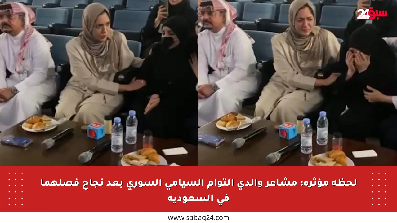 لحظة مؤثرة: مشاعر والدي التوأم السيامي السوري بعد نجاح فصلهما في السعودية